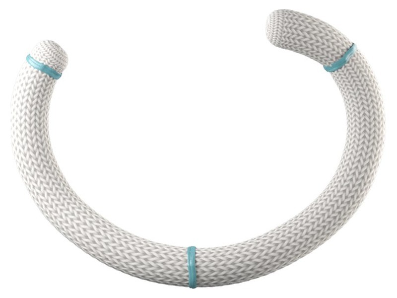 Physio Flex Annuloplasty Ring